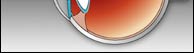 Eye - bottom